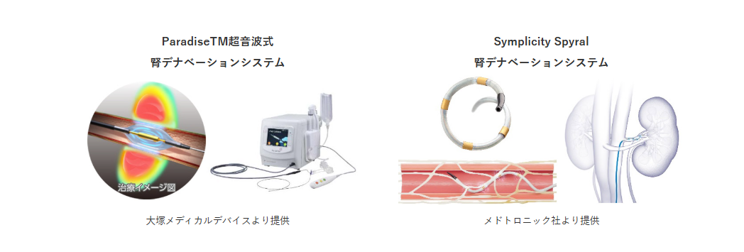 デナベ図.png